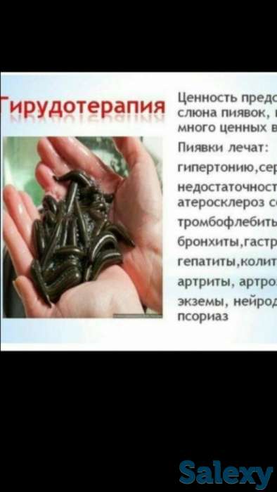 ОБУЧЕНИЕ Гирудотерапий, фотография 1