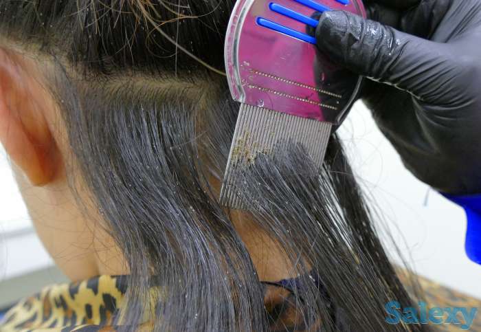 Гребень NitFree от вшей и гнид!, фотография 1