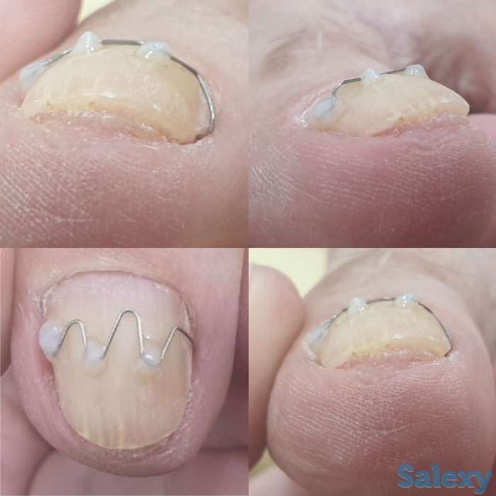 Ноги - наше всё, фотография 5