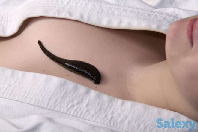 Гирудотерапия (пиявки) в Усть-Каменогорске - Центр Восточной Медицины, фотография 2