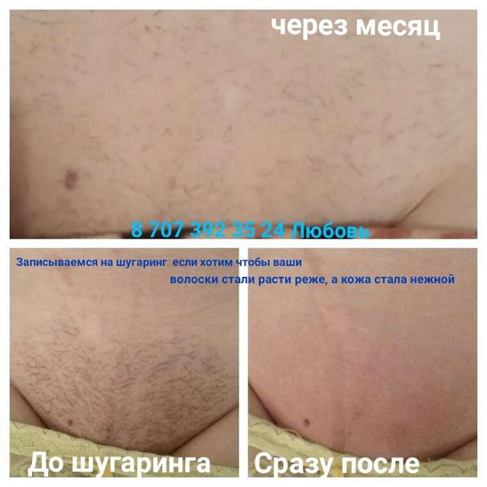 Шугаринг по доступным ценам, фотография 2