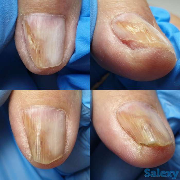 Ноги - наше всё, фотография 4