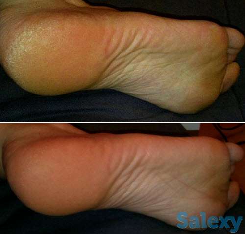 Педикюр на дому, фотография 7