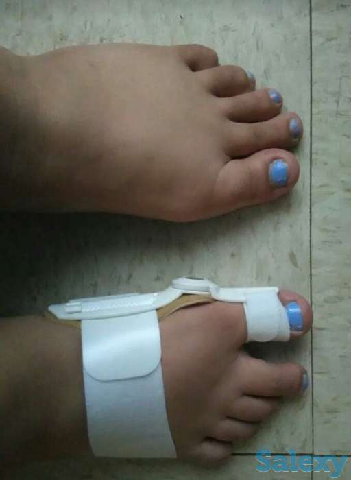 Ортопедический фиксатор для большого пальца ноги , фотография 7