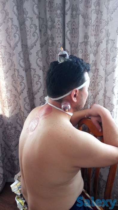 Хиджама, фотография 4