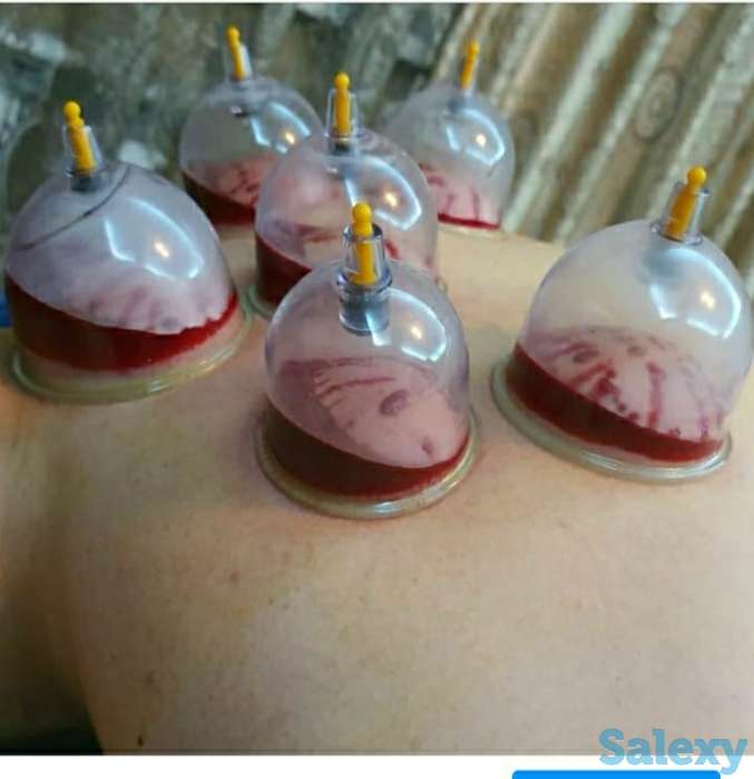 Массаж, фотография 8