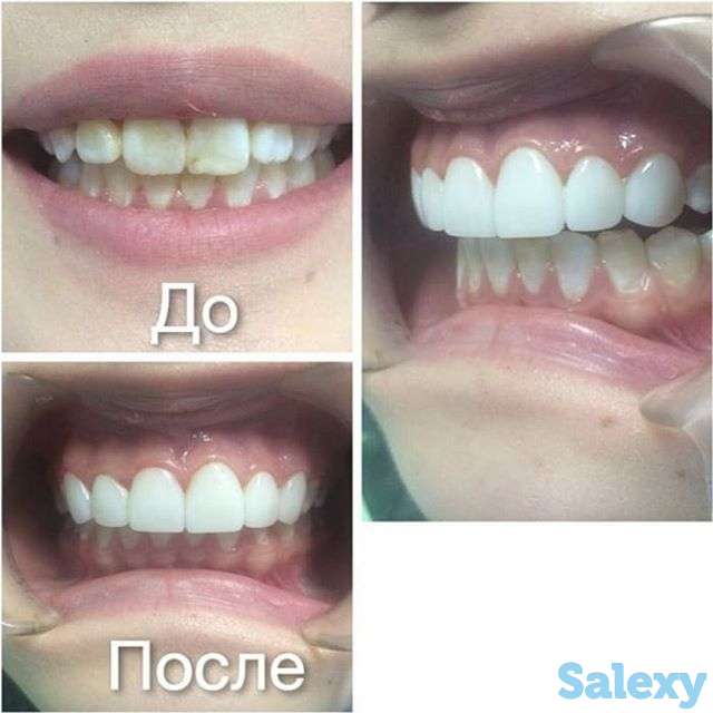 Стоматология, фотография 3