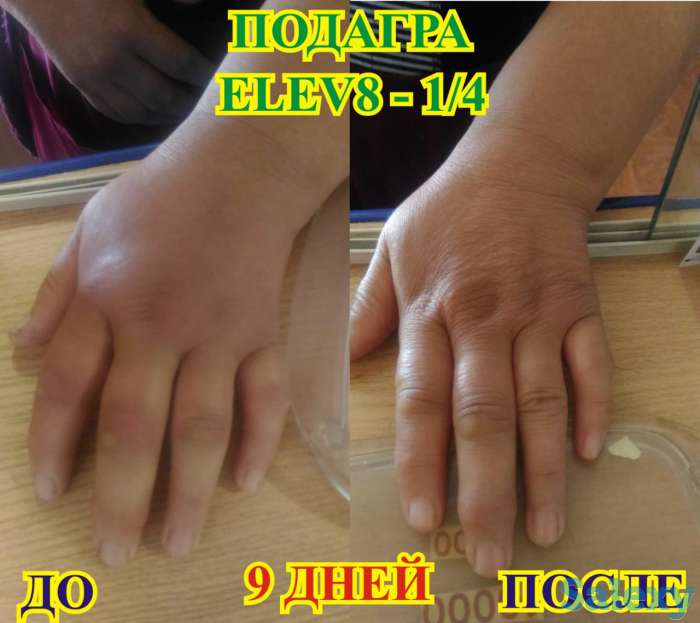 Здоровье и бизнес с продуктом правильного клеточного питания ELEV8 компании BEPIC, фотография 3