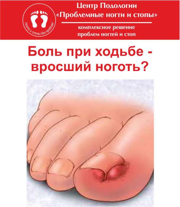 Профилактика сахарного диабета в Алматы, фотография 4