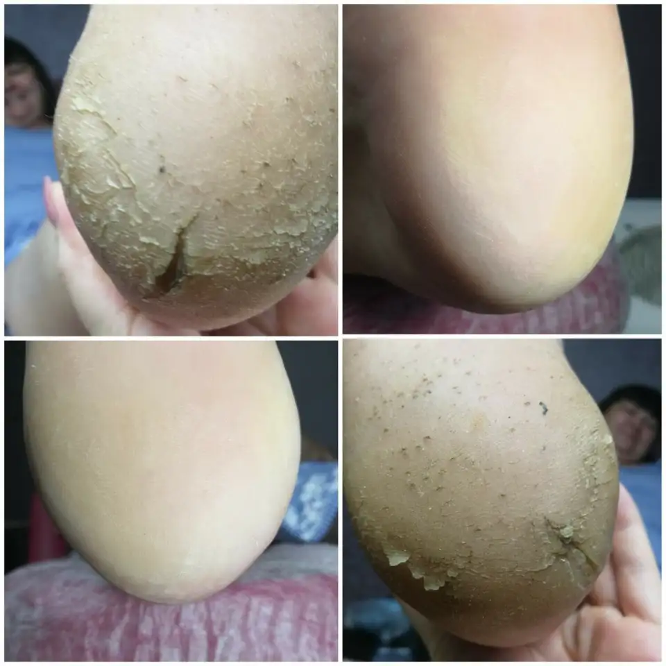 Педикюр Kart, медицинский, фотография 1