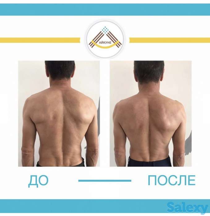 Оздоровительный центр «Айкуне», фотография 6