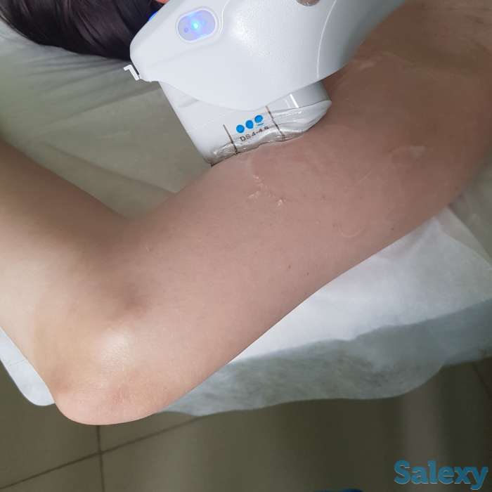 Кавитация, фотография 6