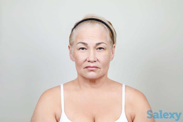 Омоложение жидкими нитями - эффект пластической операции, фотография 2