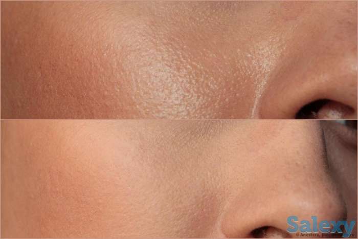 Инновация! BB glou! (тональный крем на год), фотография 5