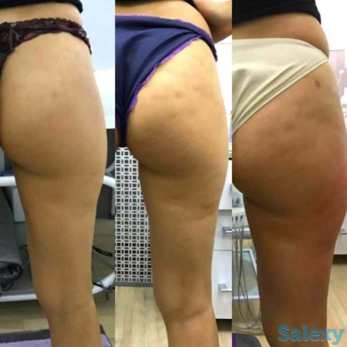 Аппаратная косметология для лица и тела, фотография 1