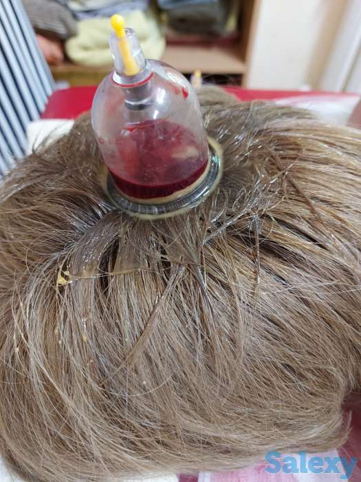 Хиджама, фотография 3