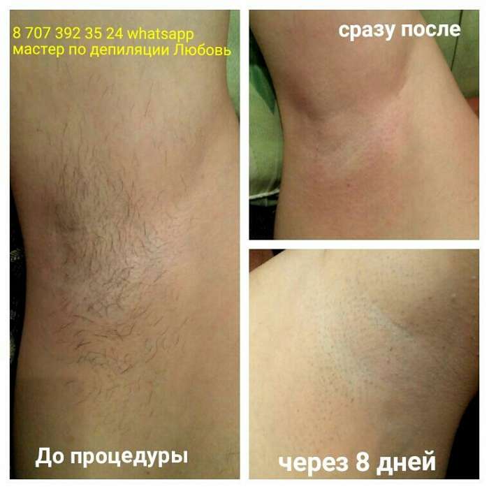 Шугаринг по доступным ценам, фотография 5