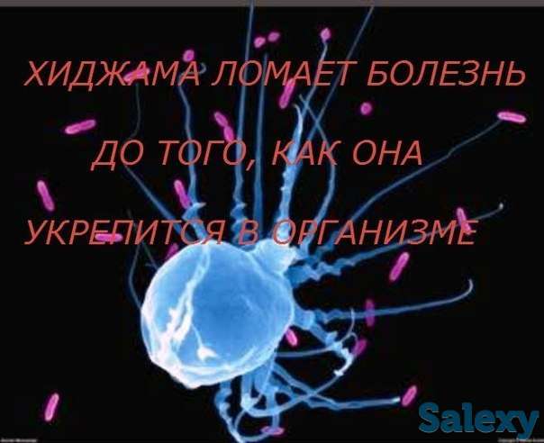 Хиджама, фотография 1