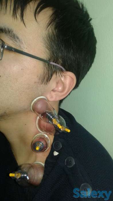 Хиджама, фотография 2