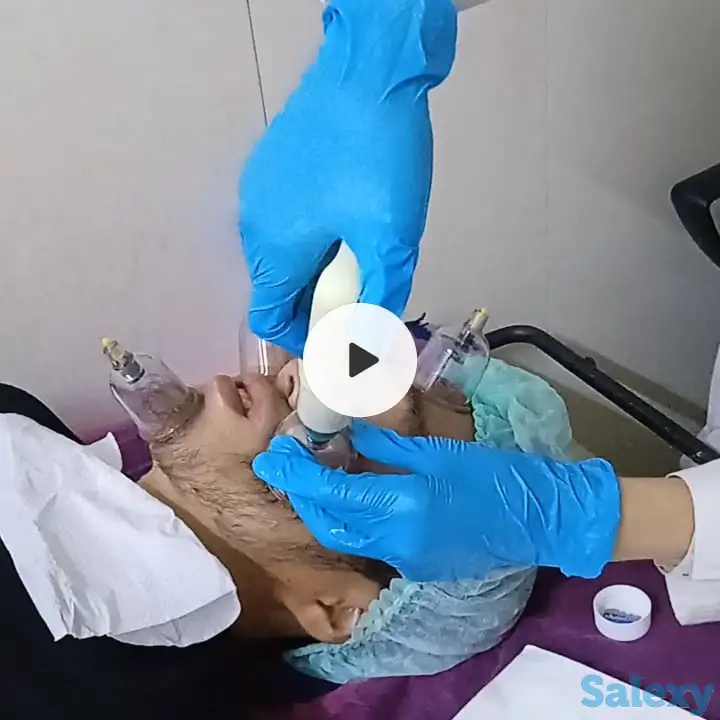 Капилляротерапия лица. Обращайтесь, фотография 1