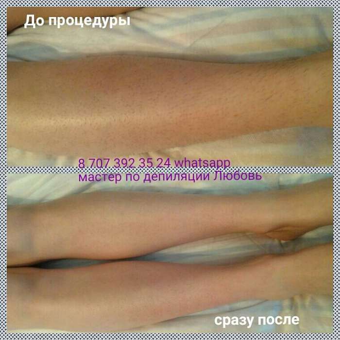 Шугаринг по доступным ценам, фотография 4