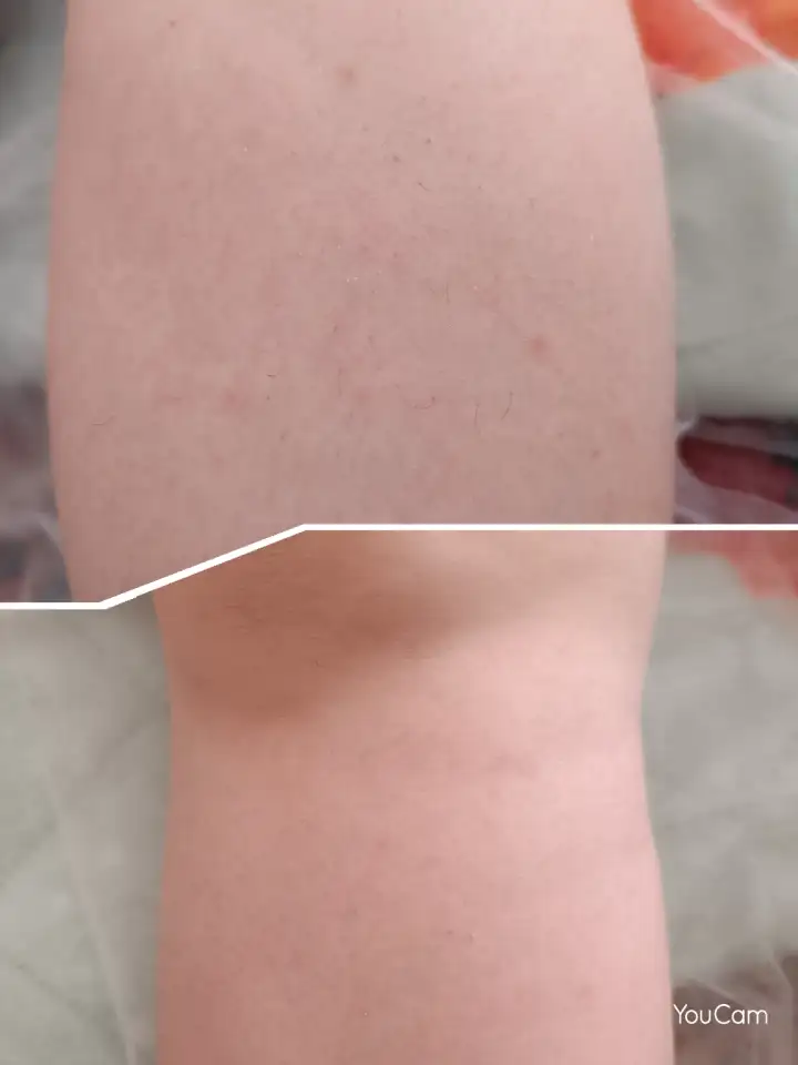 Делаю шугаринг с выездом и на дому, фотография 1