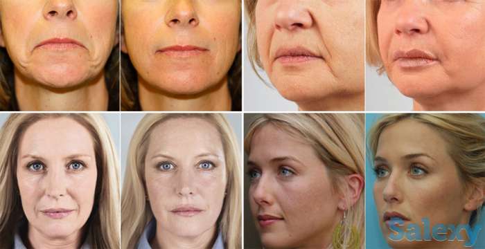 Ищем дистрибьютора в вашем городе, фотография 4