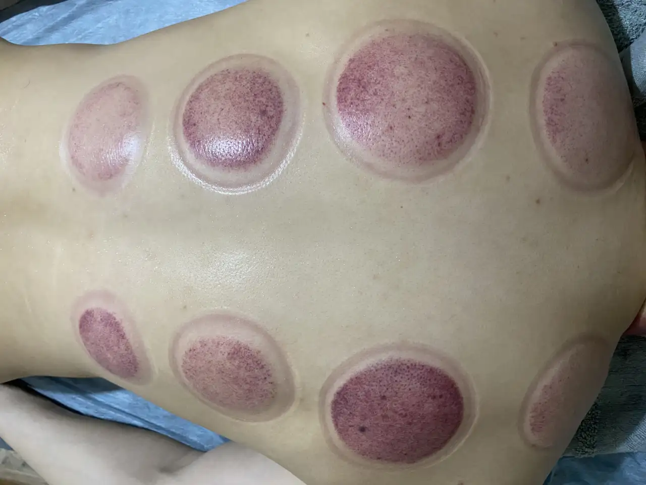 Массаж лечебный,оздоровительный, фотография 1