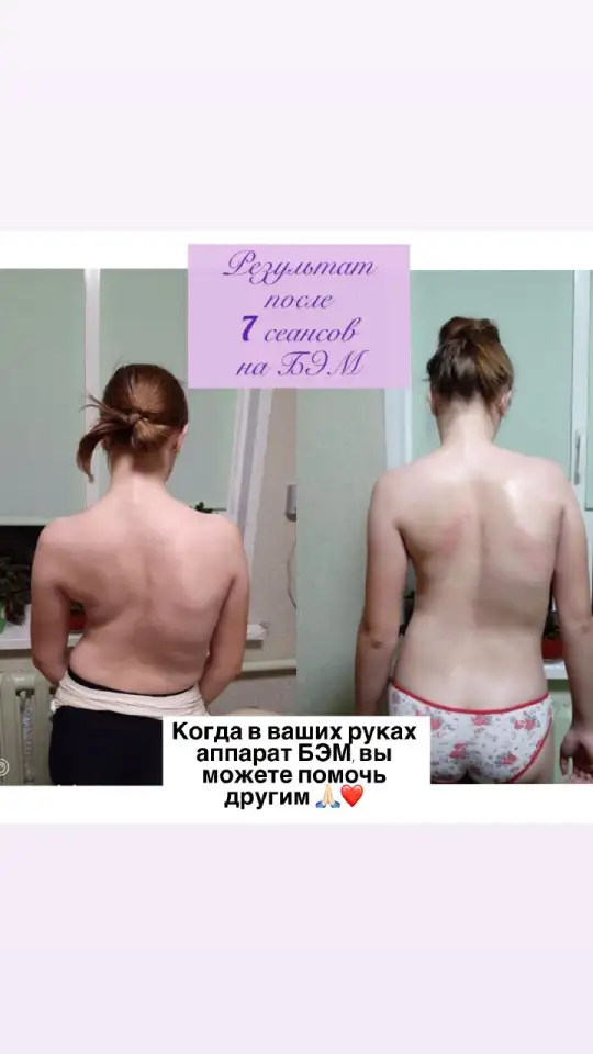 Органы под защитой биоэнергии., фотография 6