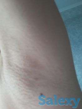 Шугаринг, фотография 4