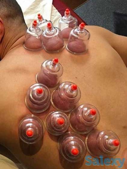 Хиджама и Массаж, фотография 3