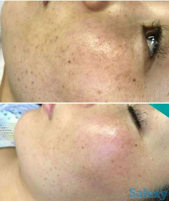 Инновация! BB glou! (тональный крем на год), фотография 8